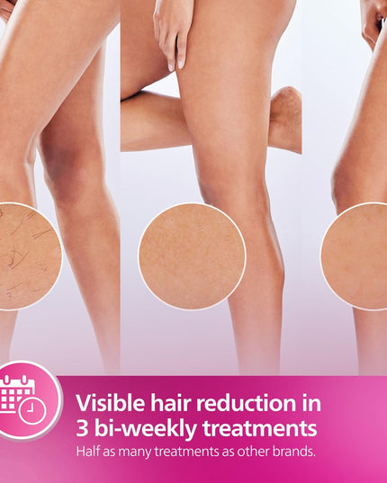 Philips Lumea 9000 Seires IPL Hair Removal