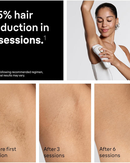 Braun IPL Silk·expert Pro 5 Hair Removal